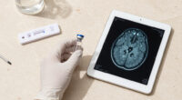 Psilocybin Tied To Lower Inflammation In Parkinson's Trial