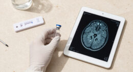 Psilocybin Tied To Lower Inflammation In Parkinson's Trial